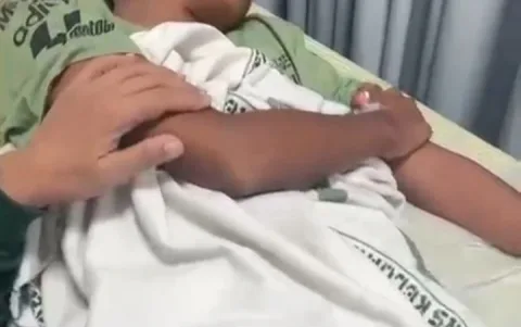 Kronologi Versi Keluarga, Siswa MTs di Pati Alami Patah Jari Usai Diduga Jadi Korban Bullying