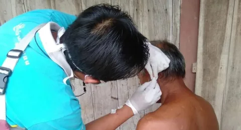 71 Warga Blora Terserang Kusta, Ada Anak-Anak