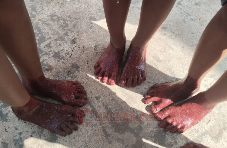 Sejumlah anak-anak hingga orang dewasa usai melakukan tradisi menyelupkan kaki ke darah hewan kurban. Foto: Antara.