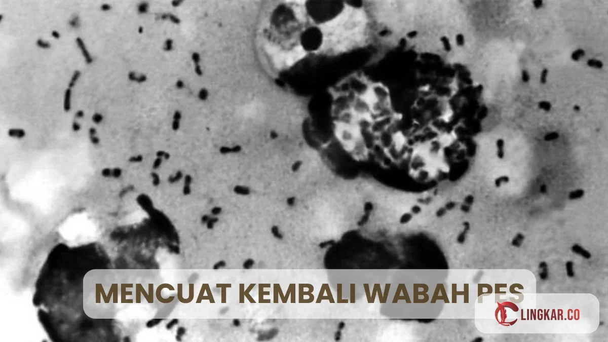 Wabah pes menyerang setelah ada kebocoran salah satu cairan laboratorium penelitian milik rusia