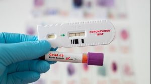 Pemerintah Turunkan Tarif Rapid Test Antigen