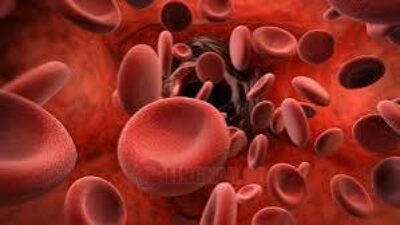 ILUSTRASI: Thalassemia, (Foto: Istimewa)